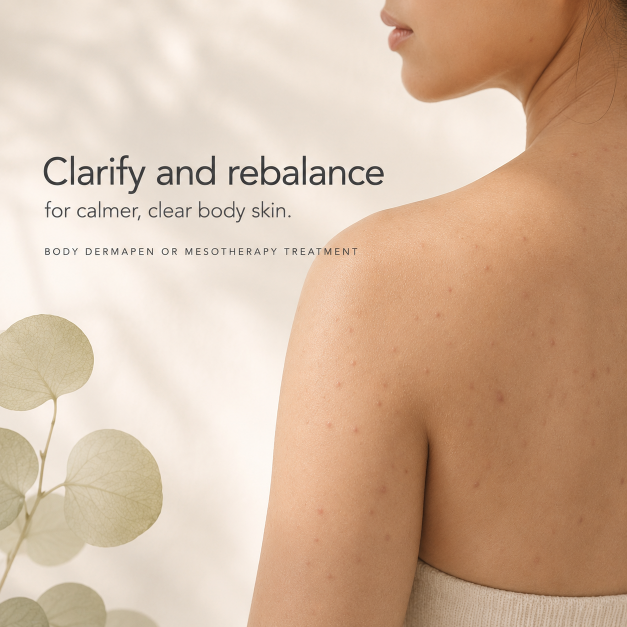 Anti-Acne Therapy