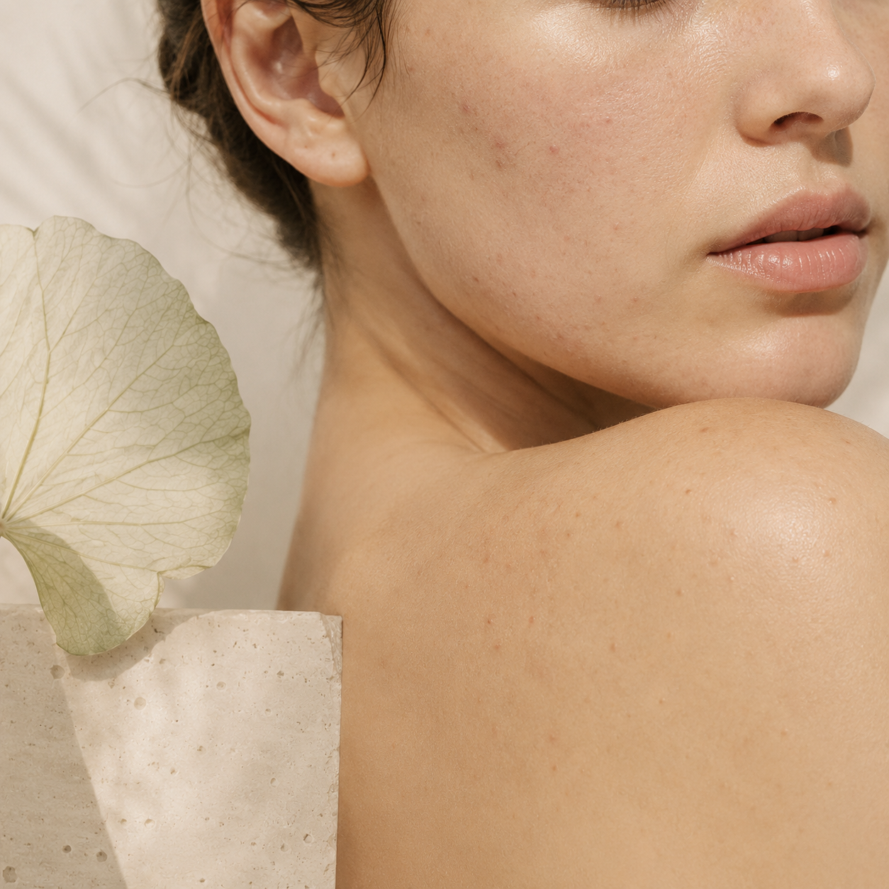 Anti-Acne Booster